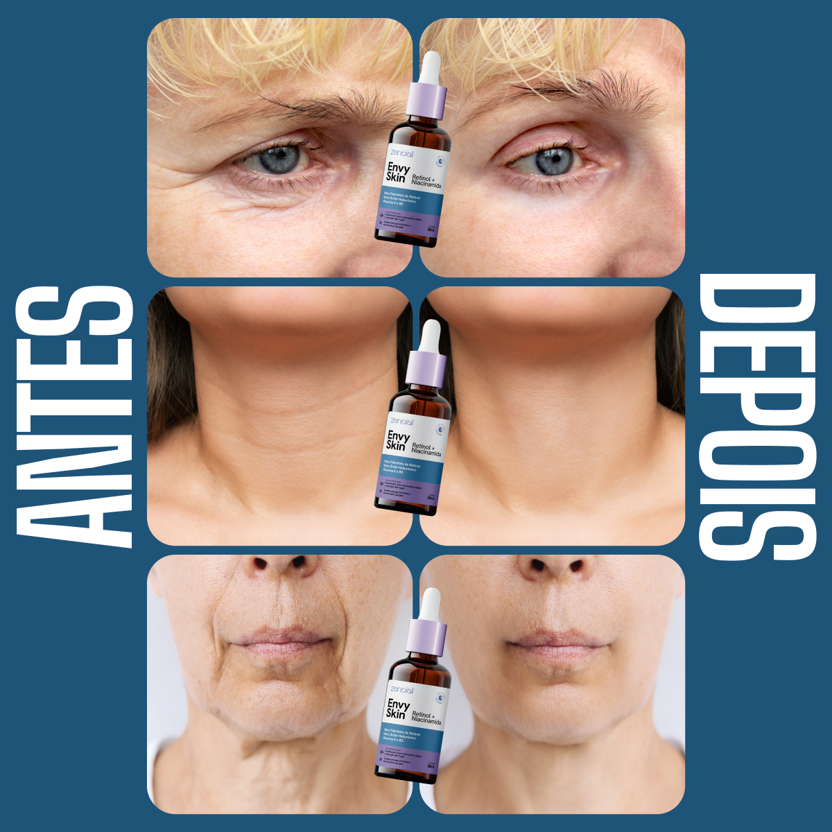 Sérum Retinol + Niacinamida