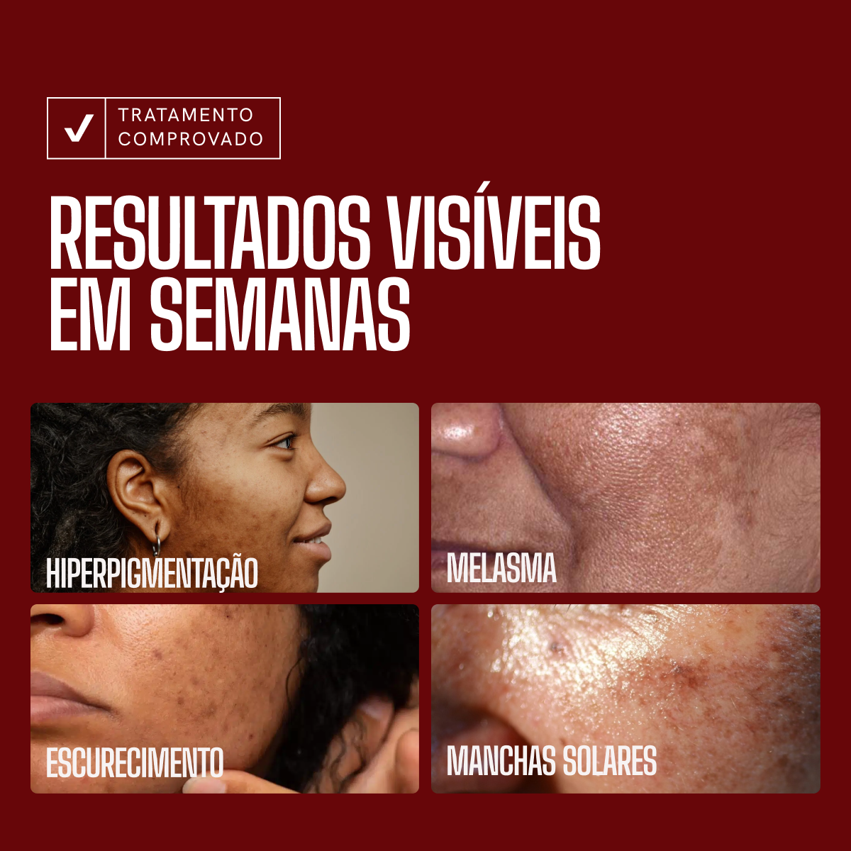 Sérum Envy Skin Tranexâmico 30ml