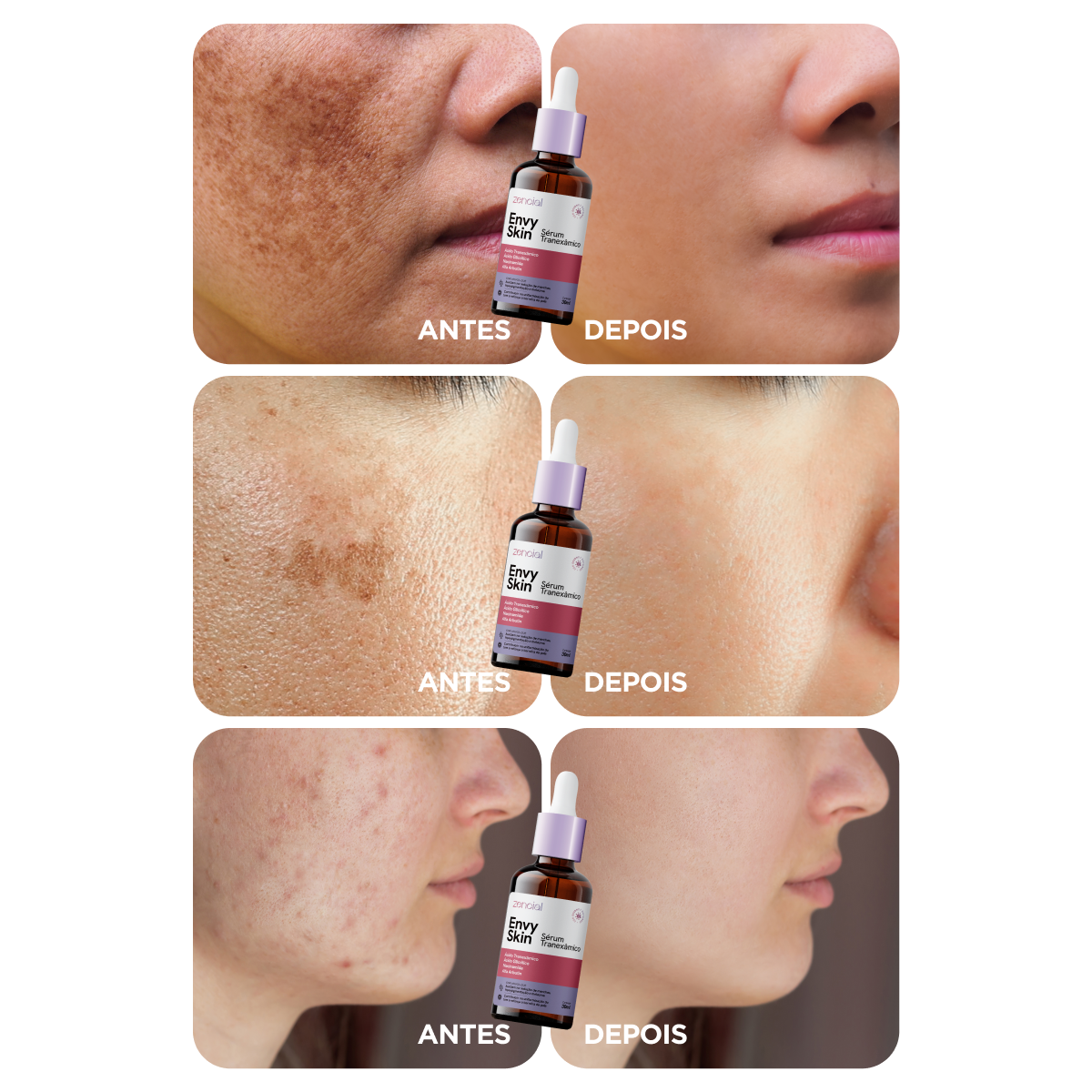 Sérum Envy Skin Tranexâmico 30ml