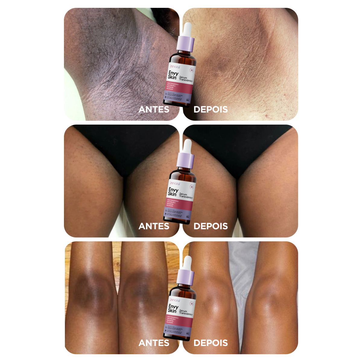 Sérum Envy Skin Tranexâmico 30ml