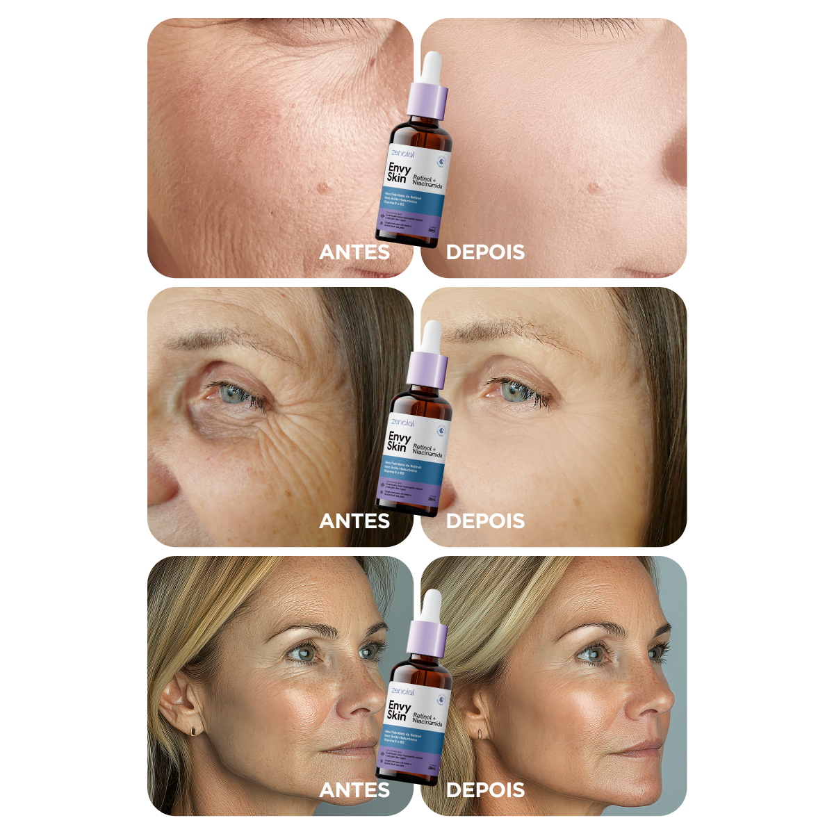 Sérum Retinol + Niacinamida