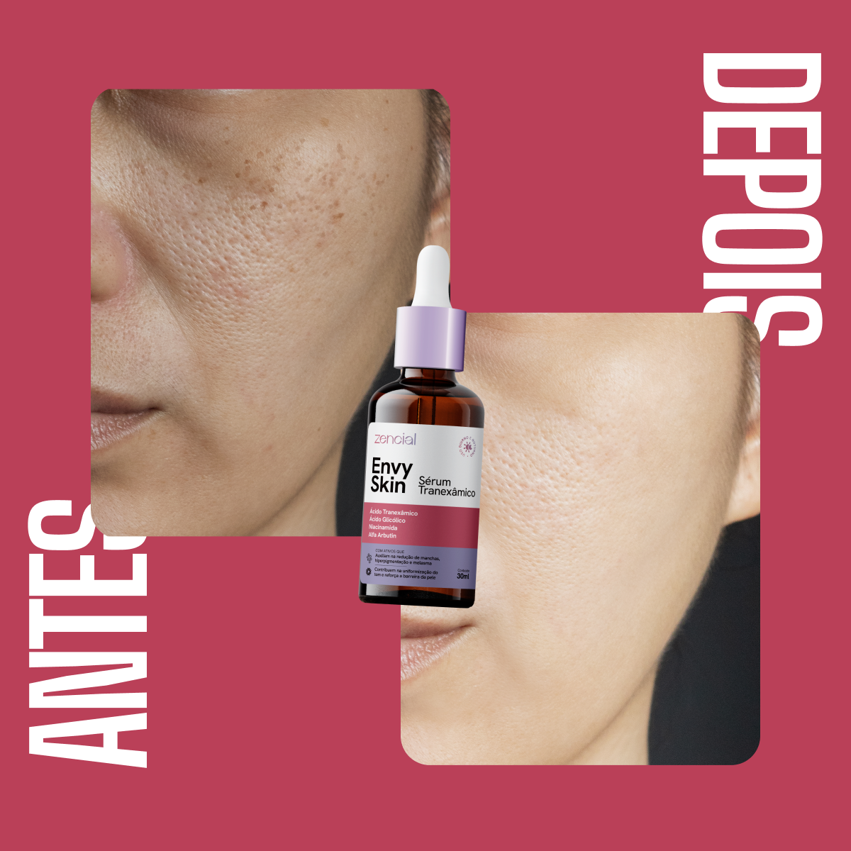Sérum Envy Skin Tranexâmico 30ml